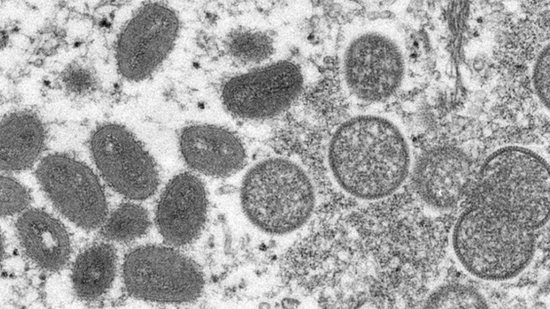 OMS define situação de emergência para varíola dos macacos - reprodução/Twitter