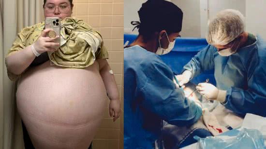 Allison tinha um tumor de 47 kgs - Reprodução/ Facebook