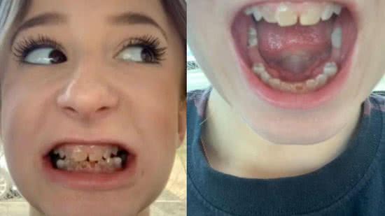 A jovem sofria bullying na escola por conta dos dentes - Reprodução/TikTok