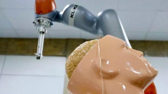 USP cria robô neurocirurgião - Getty Images