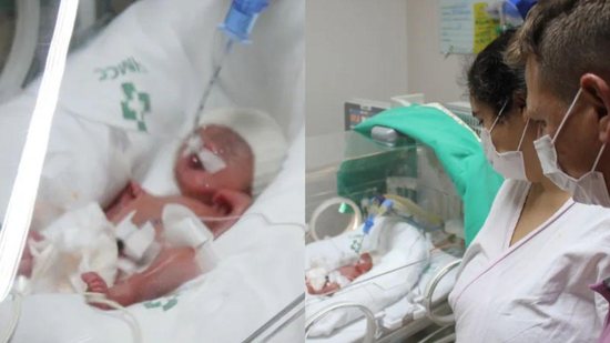 Eles nasceram de 26 semanas com o auxílio de uma enorme equipe médica - Arquivos HMCC