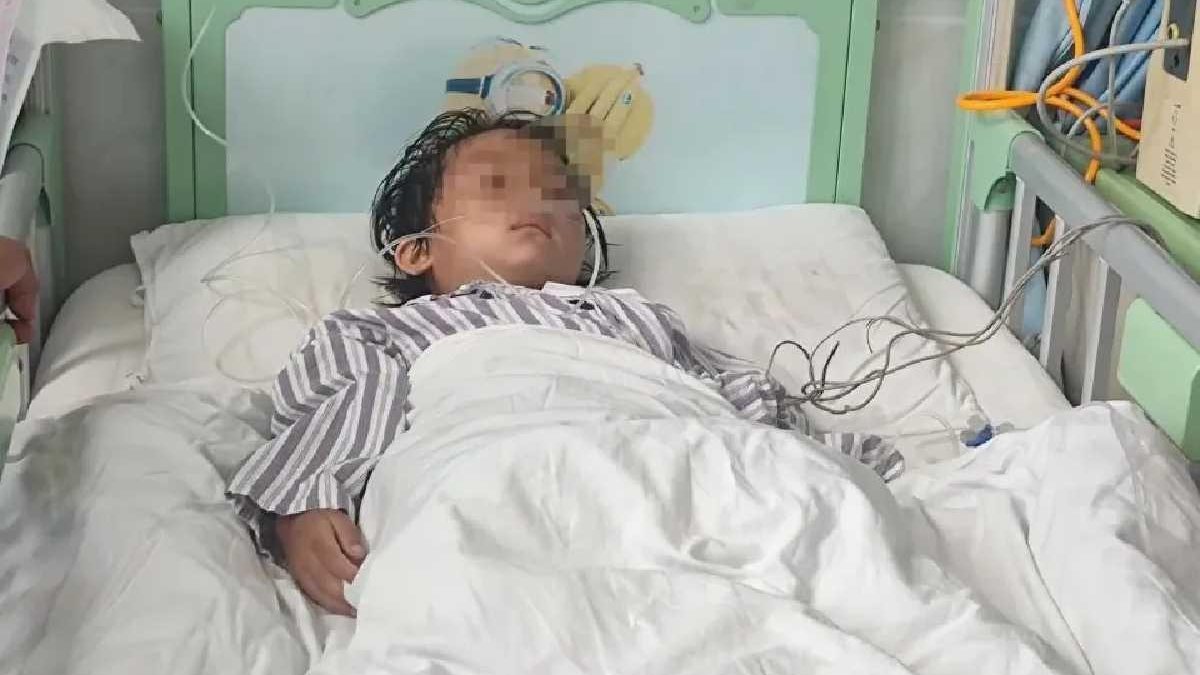 Uma sanguessuga de 15 cm foi encontrada na garganta de uma menina chinesa de 5 anos - reprodução/Wenshan Prefecture People’s Hospital of Yunnan Province