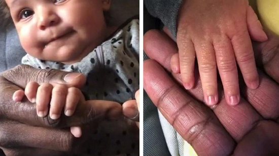 Mãe faz desabafo sobre filha que nasceu com 12 dedos - Reprodução / The Sun