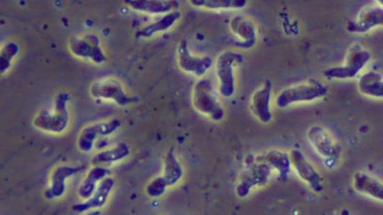 ‘Ameba comedora de cérebro' provaca morte de homem nos EUA - “Ameba comedora de cérebro’ provoca morte de homem nos Estados Unidos (Centers for Disease Control and Prevention)