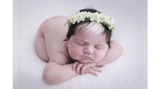 Mayah nasceu com a mesma condição da mãe, Talyta: as duas tem piebaldismo - reprodução instagram
