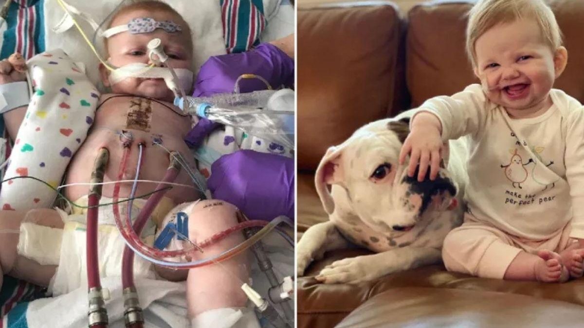 Ruby Cotter, de um ano, foi submetida a uma operação de transplante de coração de dez horas em dezembro de 2019 - Reprodução / Instagram @Metro.co.uk