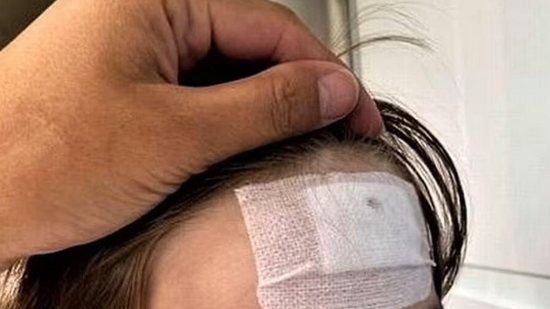 Pavão ataca menino de 3 anos em zoológico no Reino Unido e mãe faz alerta: “Poderia ter ficado cego” - reprodução Mail Online