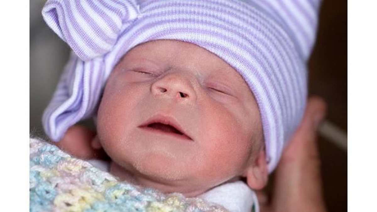 Ela nasceu dia 9 de julho - reprodução/Cleveland Clinic