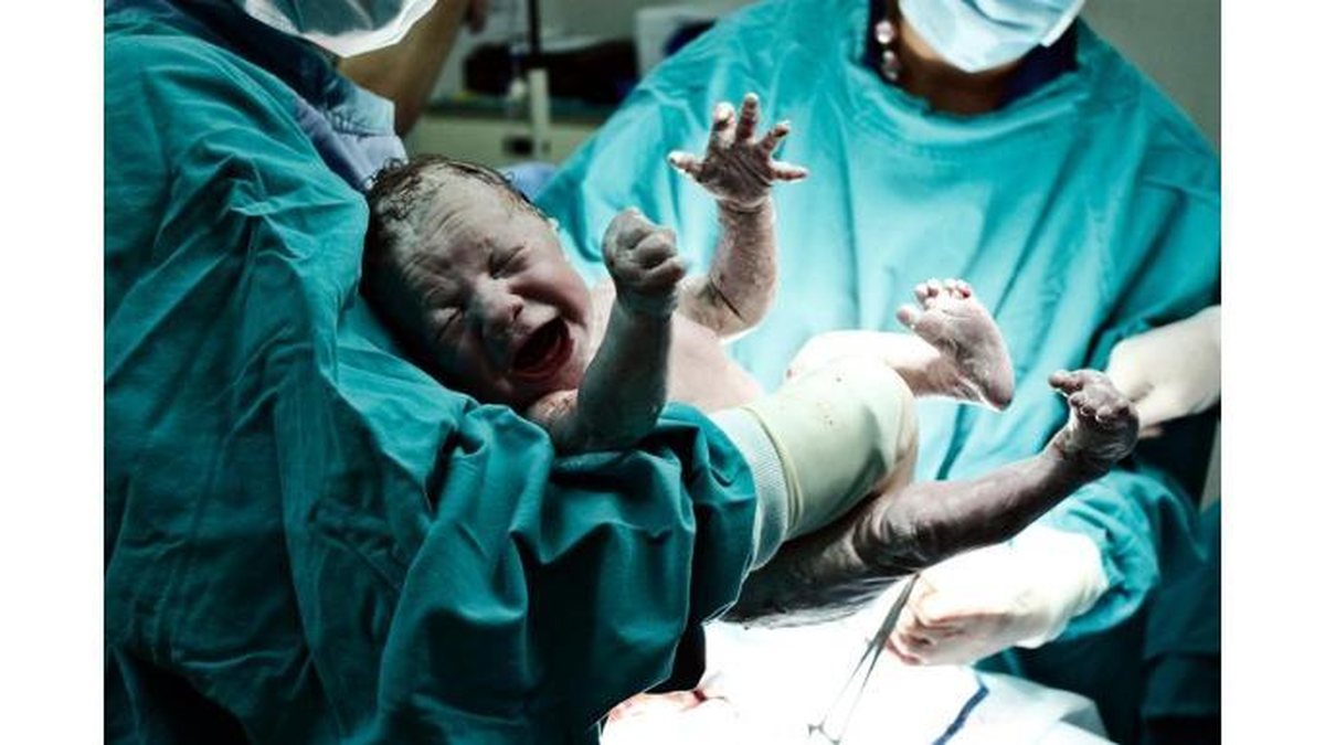 A médica deixou o próprio parto de lado para atender uma paciente / Imagem ilustrativa - Getty Images 