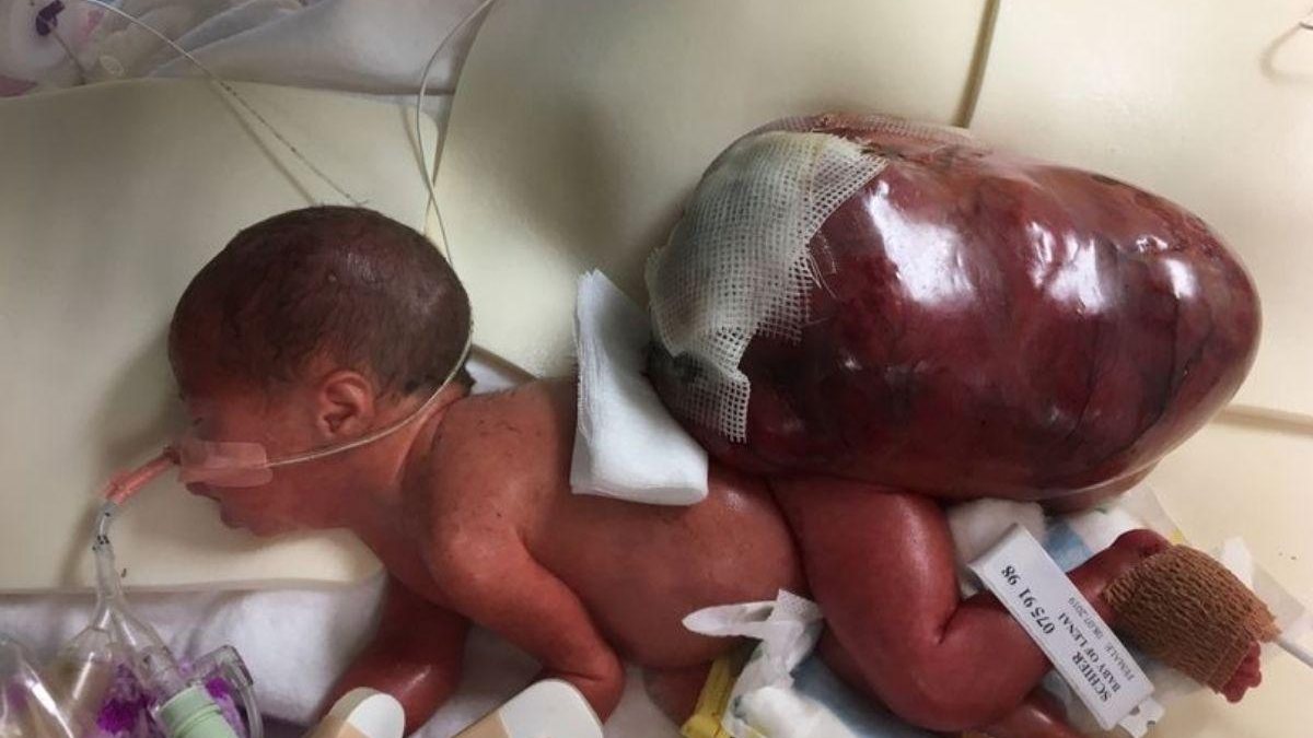 A bebê sobreviveu ao parto e a UTI - Arquivo pessoal