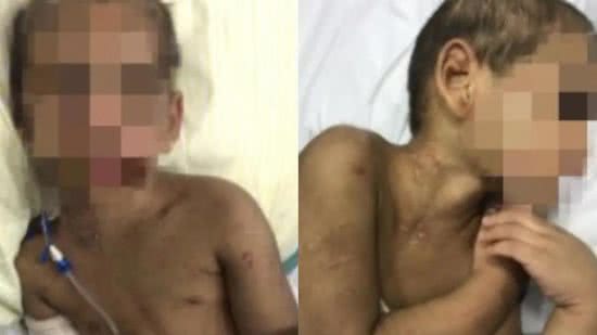 Mãe que agrediu e fraturou costelas do filho ao lado do parceiro é presa no litoral de São Paulo - Reprodução/TV Tribuna