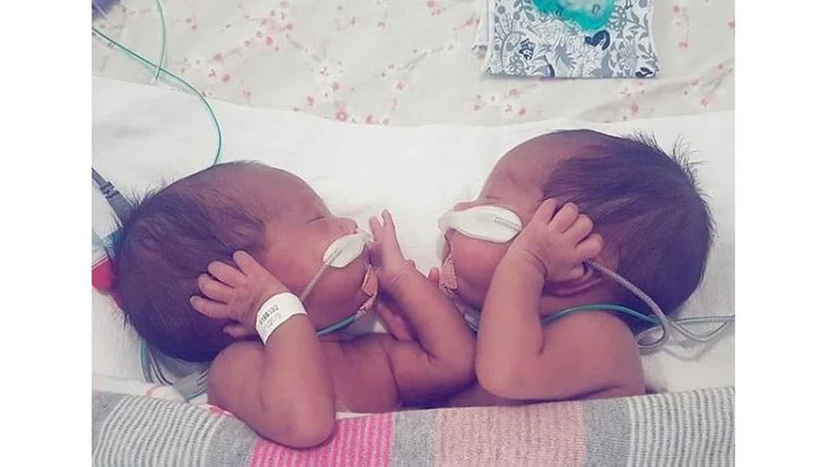 Zoe e Olivia nasceram prematuras (Foto: Reprodução / Instagram 