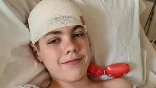 Menino de 15 anos recebe diagnóstico de tumor cerebral após sentir dores na cabeça e tontura - reprodução/Wikipedia
