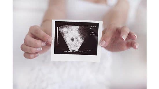 Aborto é um tema muito delicado de se abordar - Getty Images