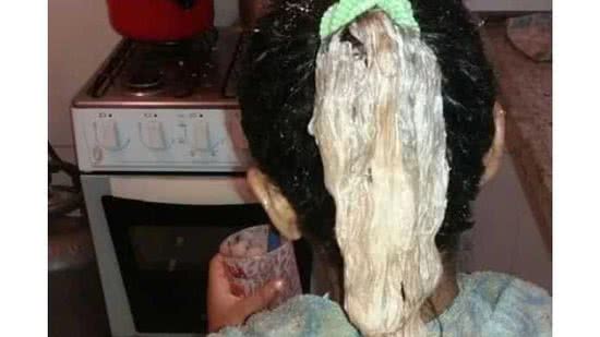 Madrasta da criança usou produtos químicos no cabelo da menina. - Reprodução/ Facebook