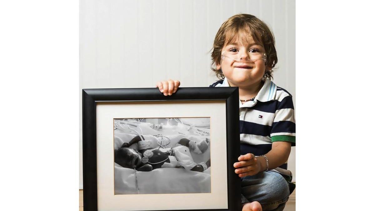 Imagem Fotógrafo registra antes e depois de crianças prematuras