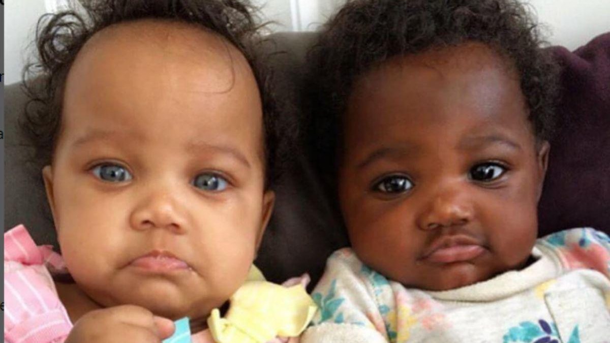 Gêmeas nascem com tonalidades de pele diferente - Reprodução/ Instagram