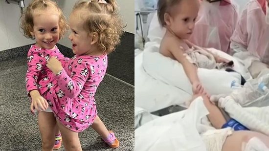 Após cirurgia de risco, gêmeas siamesas que foram separadas emocionam os médicos ao darem as mãos - Reprodução/Instagram