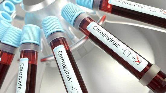 O novo coronavírus tem taxa de fatalidade menor que a da gripe - Reprodução/Getty Images