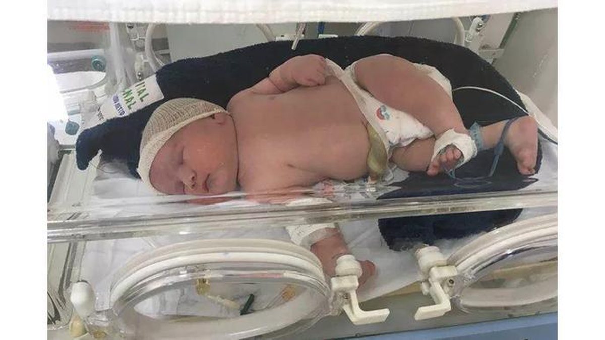 O menino veio ao mundo através de um parto cesárea - Reprodução/Ascom/HRPP