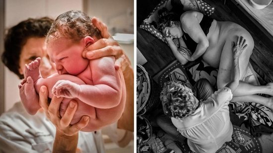Muitas mães decidem fotografar o momento do parto justamente para que nenhum detalhe passe despercebido - Getty Images