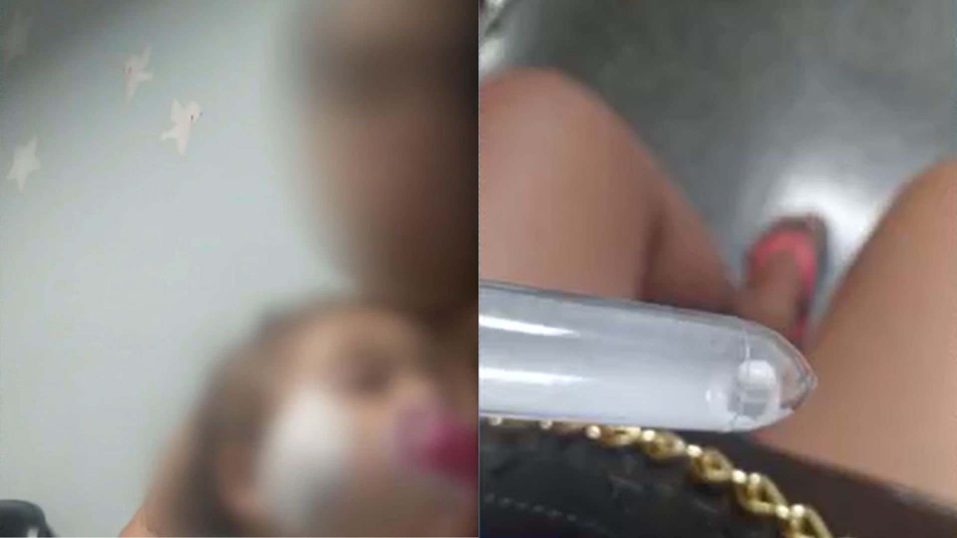 Menina de 1 ano leva tiro no rosto de bala de plástico disparada por PM