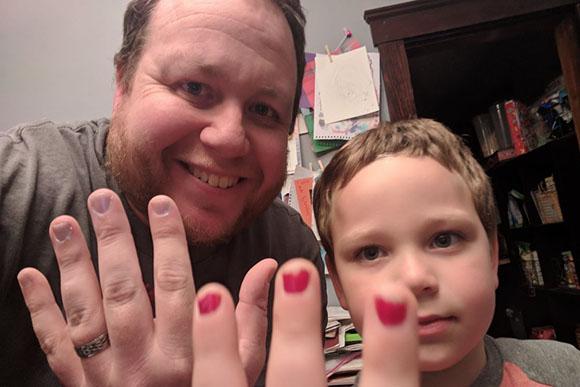 Pai pintou as unhas para que o filho não se sentisse diferente (Foto: Reprodução/ Twitter @Menino gosta de pintar as unhas e sofre bullying na escola (Foto: Reprodução/ Twitter @Daddy Files)