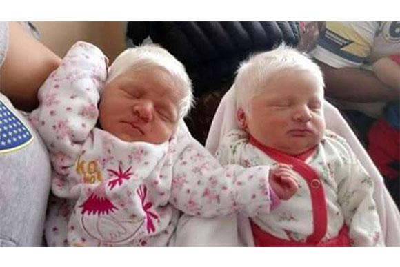As meninas nasceram com 36 semanas (Fonte: Reprodução/ Facebook Rioja On Line