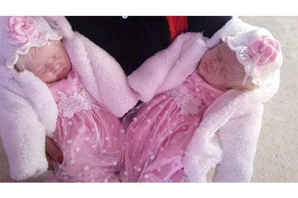 Elas são as primeiras gêmeas albinas da Argentina (Foto: Reprodução/ Portal +Vibes)