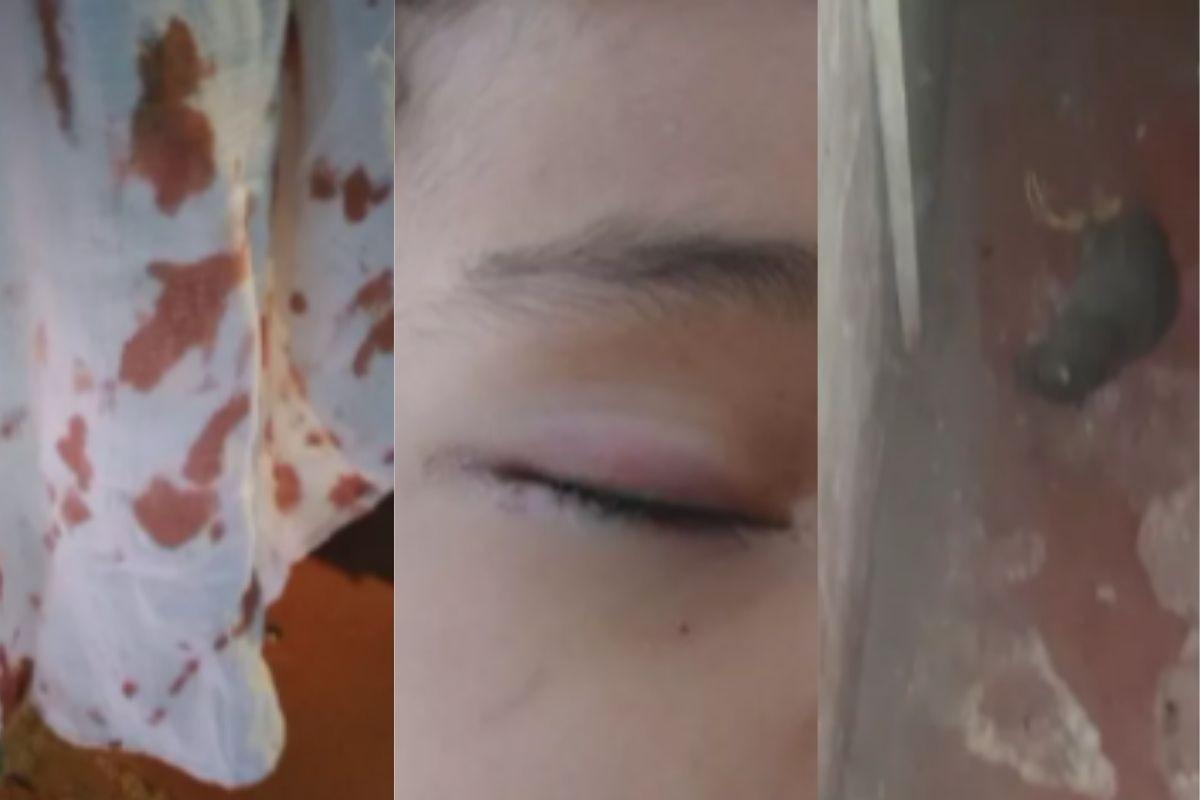 Criança de 3 anos é ferida no rosto após ser atacada por um rato enquanto dormia 