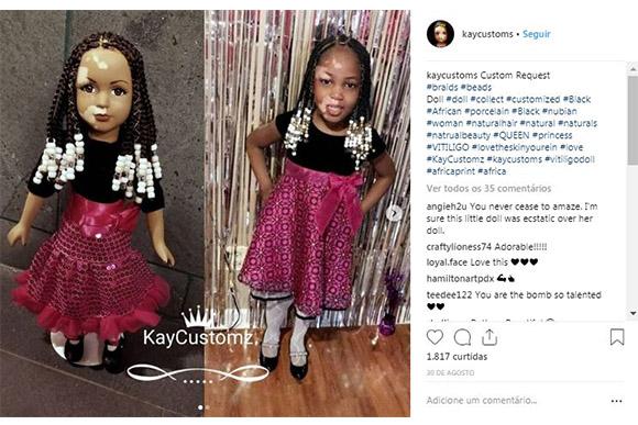 Artesã norte-americana produz linha de bonecas com vitiligo (Foto: Reprodução/ Instagram @kaycustoms)