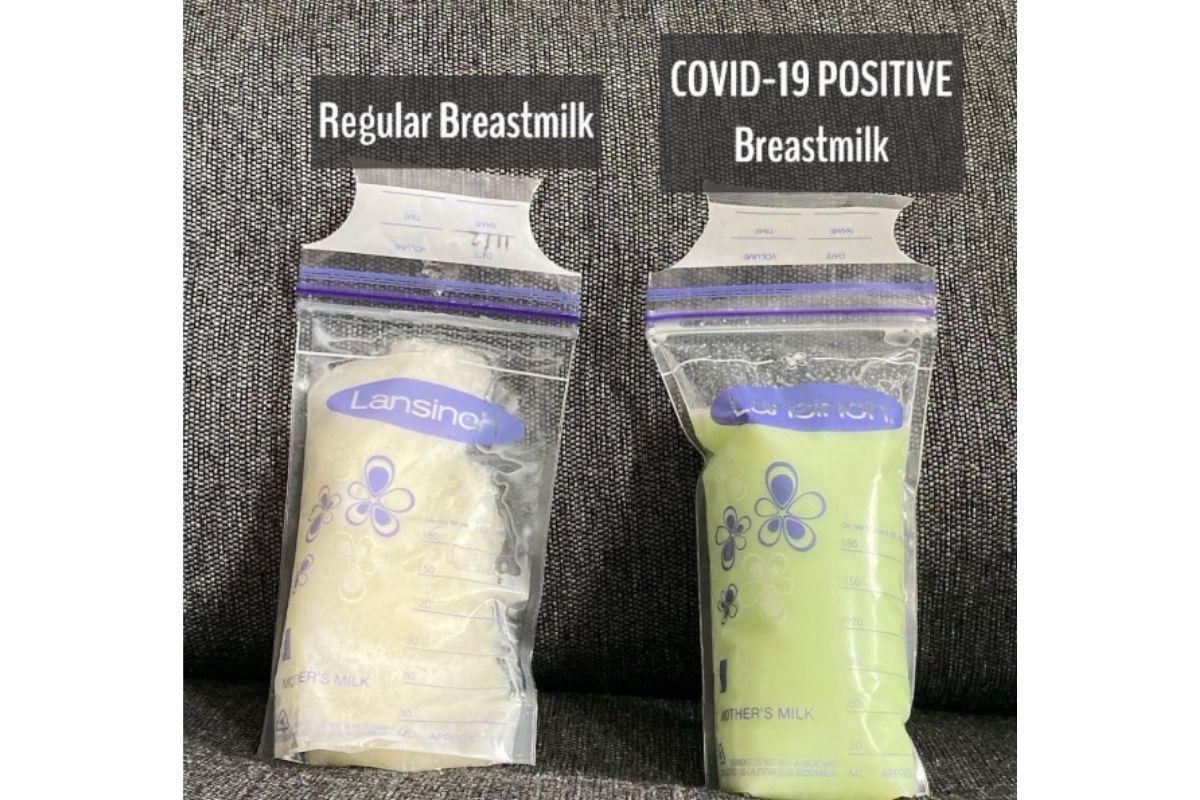 A mãe publicou uma imagem mostrando o leite materno normalmente e o mesmo líquido após o diagnóstico de covid