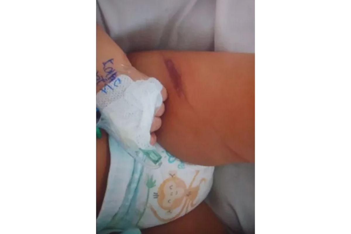 A criança de 8 meses foi encontrada com ferimentos pelo corpo 