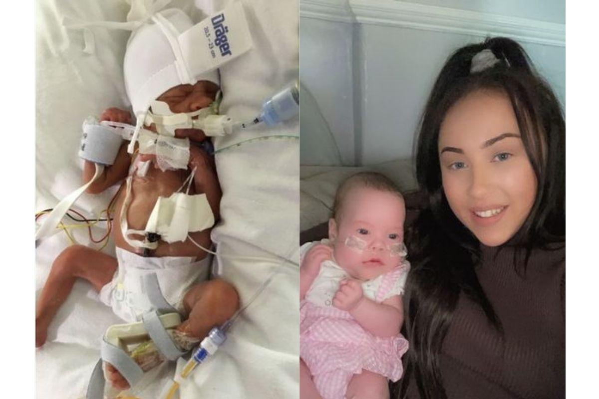 A direita Ayla no hospital e a esquerda Jasmine com a filha após ela receber alta