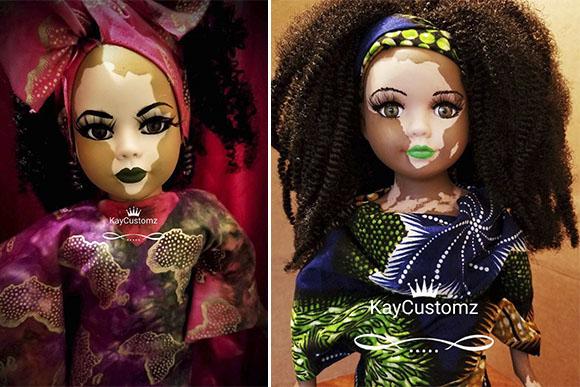 A artista Kay Black produz bonecas com vitiligo personalizadas (Foto: Reprodução/ Instagram @kaycustoms)