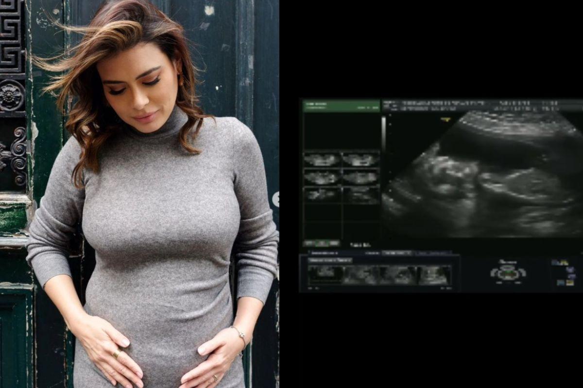 A jornalista está gravida pela primeira vez e anunciou o nome da filha