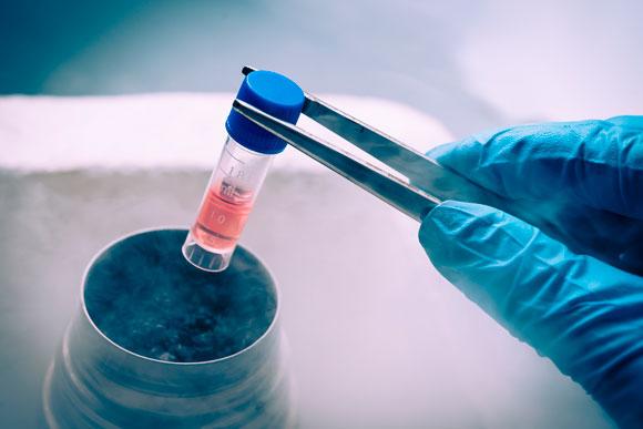Pesquisas estão sendo feitas em busca de um tratamento para a renovação das células tronco (Foto: Shutterstock)